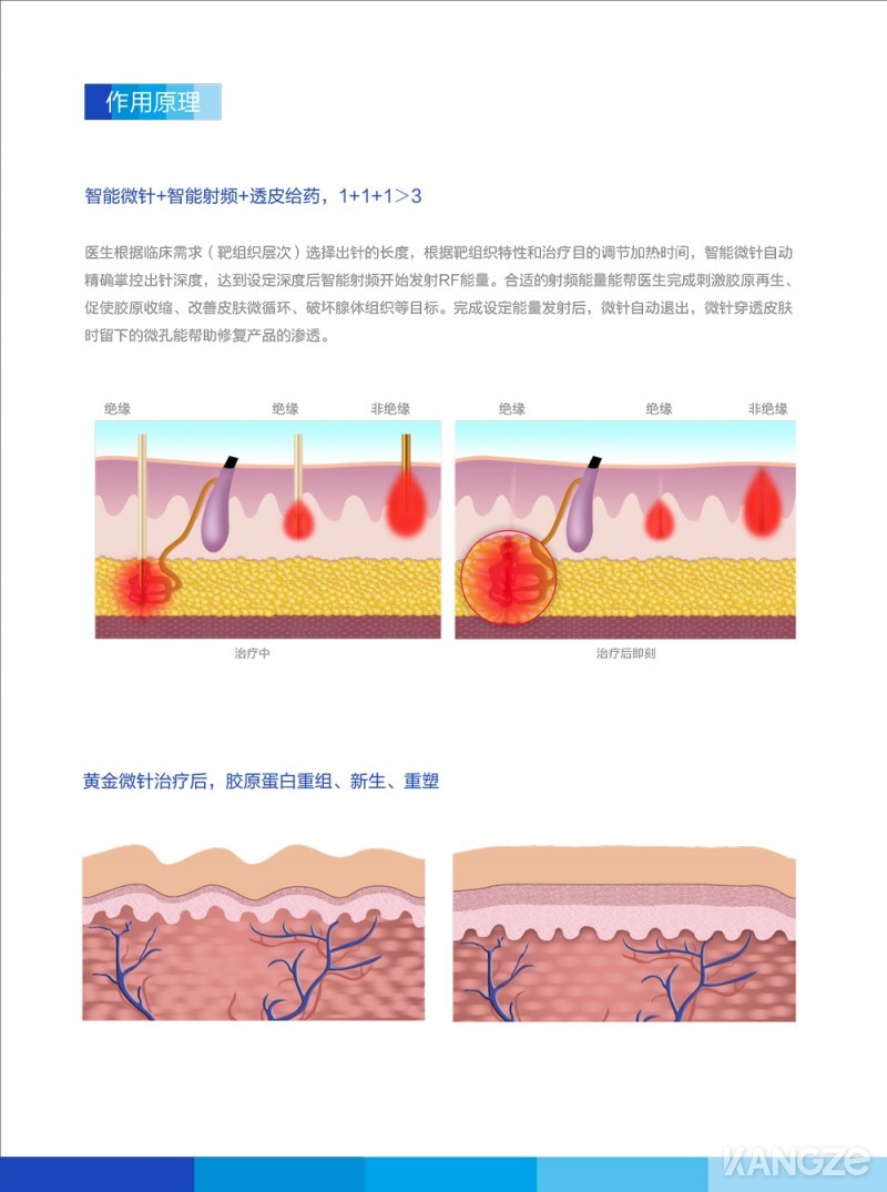 彩頁(yè)-第4代黃金微針4